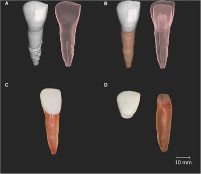 Students’ perceptions of endodontic typodont teeth with simulated canals printed from novel materials